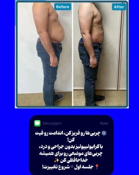 لاغری در تهران